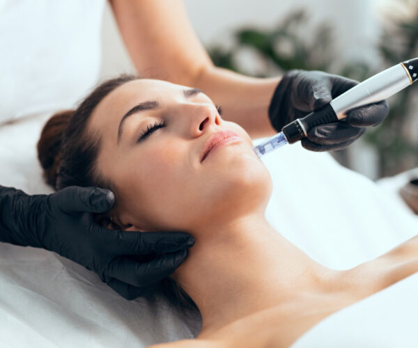 Microneedling