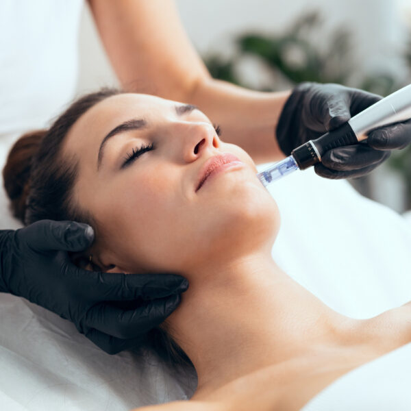 Microneedling