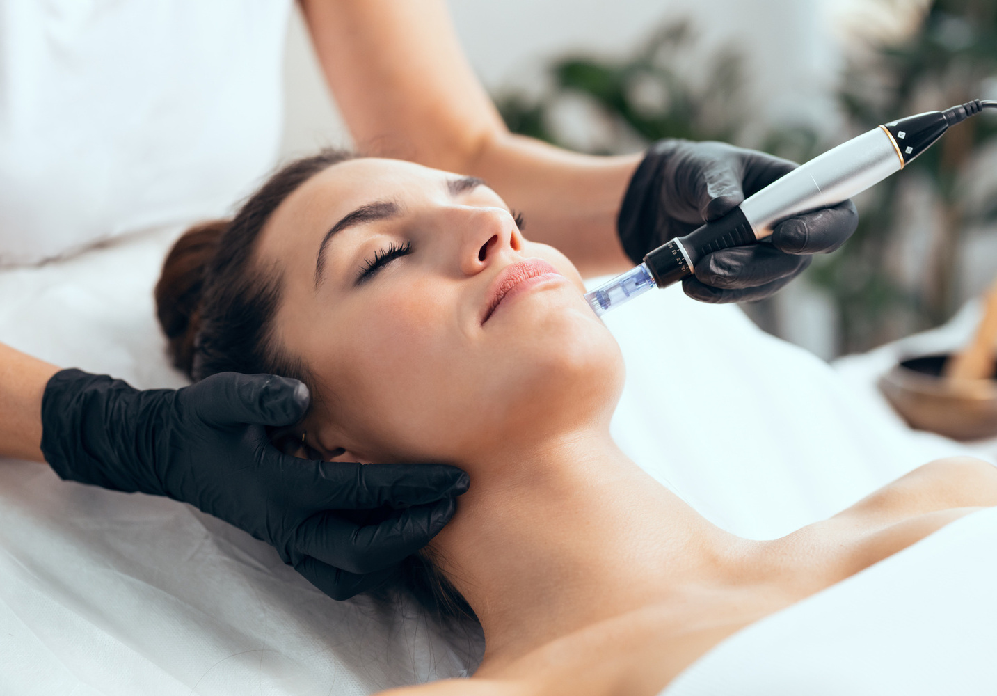 Microneedling